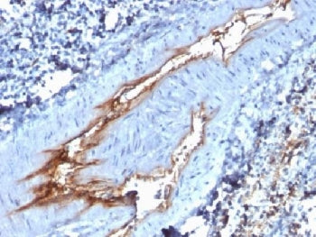 IHC testing of FFPE human spleen with vWF antibody (clone VWF/1767). Required HIER: boil tissue sect