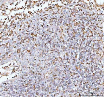 IHC staining of FFPE human spleen tissue with IL22 antibody. HIER: boil tissue sections in pH8 EDTA 