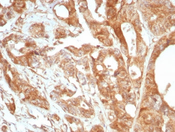 IHC staining of FFPE human prostate tissue with Glycoprotein 36 antibody (clone PDPN/8875R). HIER: b