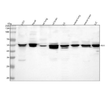 Western blot analysis of IRX1 using anti-IRX1 antibody. Lane 1: human U251 whole cell lysates, Lane 