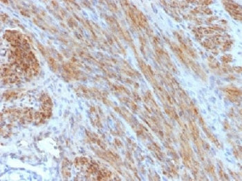 IHC testing of FFPE human uterus with Desmin antibody (clone DES/1711). Required HIER: boil tissue s