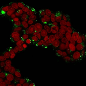 CTSD Antibody / Cathepsin D