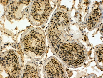 UBR5 Antibody