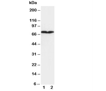 Collagen III Antibody / COL3A1