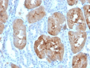 FABP1 Antibody