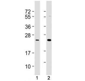 RAB7L1 Antibody
