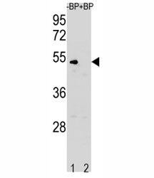 Western blot analysis of Cyclin B antibody pre-incubated without (Lane 1) and with (2) blocking pept