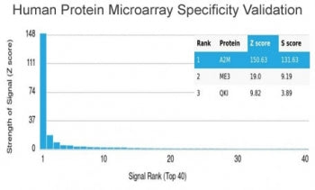 Alpha-2-M Antibody / Alpha-2-Macroglobulin / A2M