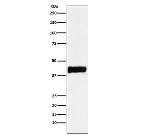 Western blot testing of human SH-SY5Y cell lysate with CKB antibody. Predicted molecular weight ~43 