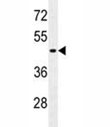 GFAP Antibody (Glial Fibrillary Acidic Protein)