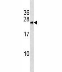 BNIP1 Antibody