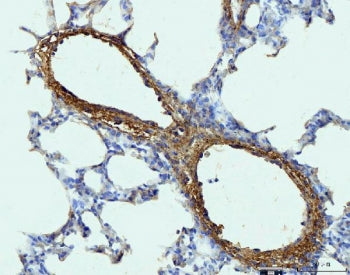 Collagen I Antibody / COL1A1