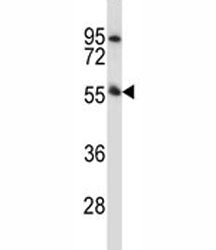 Pink1 antibody western blot analysis in mouse heart tissue lysate. Predicted molecular weight: 60-70