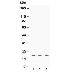 Western blot testing of 1) rat brain, 2) mouse NIH3T3 and 3) human HeLa lysate with LMO1 antibody at