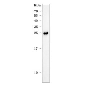 Western blot testing of rat liver tissue lysate with Ang antibody. Predicted molecular weight ~16 kD