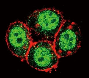 Confocal immunofluorescent analysis of PAK1 antibody with HeLa cells followed by Alexa Fluor 488-con