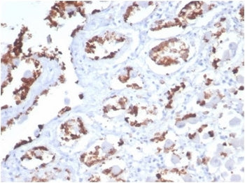 IHC staining of FFPE human stomach tissue with recombinant MUC5AC antibody (clone MUC5AC/7068R) at 2