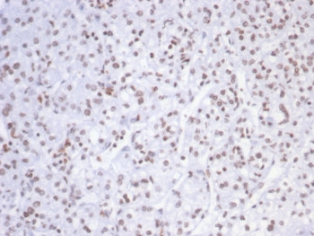 SMARCAL1 Antibody