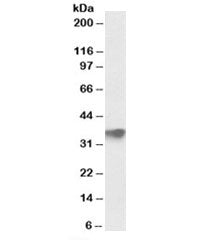 FBXO4 Antibody