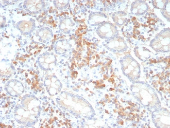 IHC staining of FFPE human colon tissue with Pan-Cadherin antibody (clone Pan-CAD/8019). HIER: boil 