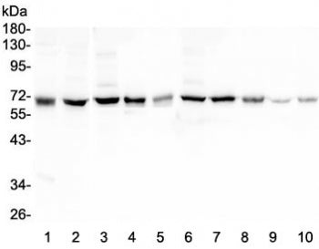 Western blot testing of 1) human SHG-44, 2) human ThP-1, 3) rat brain, 4) rat smooth muscle, 5) rat 