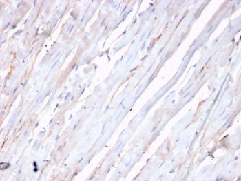 IHC staining of FFPE human heart with recombinant CDH2 antibody. HIER: boil tissue sections in pH 9 