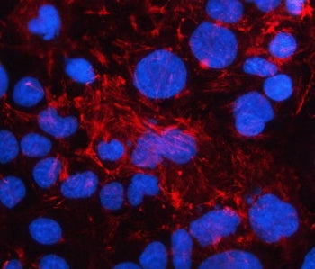 Immunofluorescent staining of FFPE human Caco-2 cells with Ladinin 1 antibody (red) and DAPI nuclear