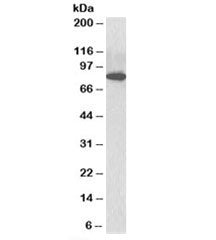 Western blot testing of C57/B6 mouse CTL lysate with ODF2 antibody at 3ug/ml. Predicted molecular we