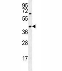 AMACR Antibody