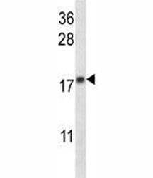 MGMT Antibody