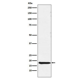 TSH beta Antibody / TSHB