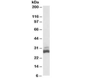 SDHB Antibody