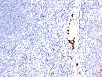 CSF3 Antibody / Granulocyte-Colony Stimulating Factor