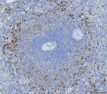 IHC staining of FFPE human spleen tissue with GZMK antibody. HIER: boil tissue sections in pH8 EDTA 