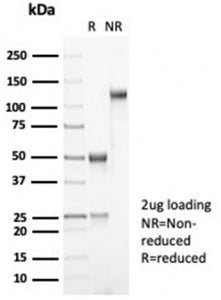 SDS-PAGE analysis of purified, BSA-free recombinant MDM2 antibody (clone MDM2/7061R) as confirmation