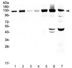 EPHA2 Antibody / Eph Receptor A2