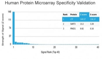 LTF Antibody / Lactoferrin / Lactotransferrin