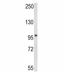 RIG-I Antibody (DDX58)