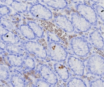 IHC staining of FFPE human stomach (corpus) with recombinant BCMA antibody (clone CD269/7986R). HIER