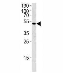 SOCS4 Antibody