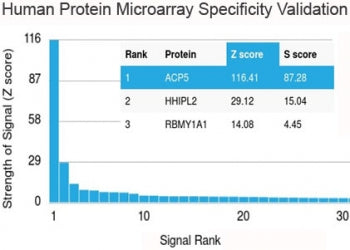 TRAcP Antibody / TRAP / ACP5