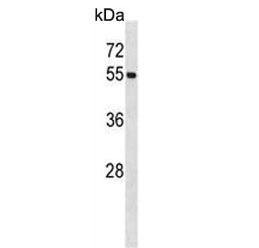 UBE1C Antibody / UBA3