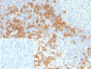 IHC staining of FFPE human tonsil tissue with CD38 antibody (clone CD38/8114R). Inset: PBS used in p