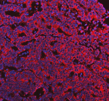 Immunofluorescent staining of FFPE human stomach tissue with AqCbl reductase antibody (red) and DAPI