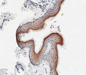 SCEL Antibody / Sciellin