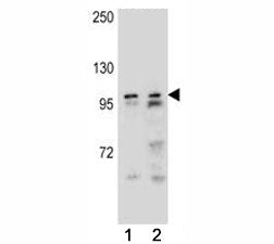 Androgen Receptor Antibody