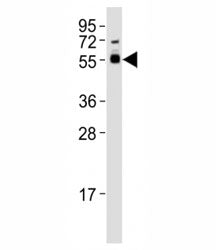 Western blot testing of SMAD3 antibody at 1:1000 dilution + mouse brain lysate; Observed molecular w