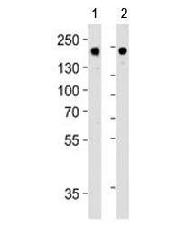 Western blot analysis of lysate from 1) MDA-MB-453 and 2) SK-BR-3 cell line using HER-2 antibody at 