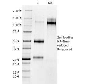 SDS-PAGE analysis of purified, BSA-free Matrix Metalloproteinase 3 antibody as confirmation of integ