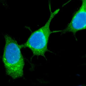 Estrogen Inducible Protein pS2 / TFF1 Antibody